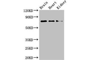 Western Blot Positive WB detected in: Mouse brain tissue, Mouse heart tissue, Mouse kidney tissue All lanes: PDIA4 antibody at 4 μg/mL Secondary Goat polyclonal to rabbit IgG at 1/50000 dilution Predicted band size: 73 kDa Observed band size: 73 kDa (PDIA4 抗体  (AA 101-400))