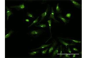Immunofluorescence of purified MaxPab antibody to PDXDC1 on HeLa cell. (PDXDC1 抗体  (AA 1-788))