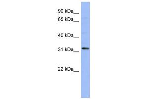 WB Suggested Anti-TLX1 Antibody Titration:  0. (TLX1 抗体  (N-Term))