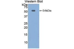 Western Blotting (WB) image for anti-Mesothelin (MSLN) (AA 400-615) antibody (ABIN1859885) (Mesothelin 抗体  (AA 400-615))