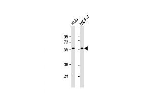 Western Blot at 1:1000 dilution Lane 1: Hela whole cell lysate Lane 2: MCF-7 whole cell lysate Lysates/proteins at 20 ug per lane. (TIGD1 抗体  (N-Term))