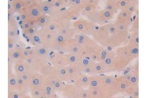 Detection of HEXb in Human Liver Tissue using Polyclonal Antibody to Hexosaminidase B Beta (HEXb) (HEXB 抗体  (AA 122-311))