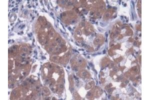 Detection of MTX1 in Human Stomach Tissue using Polyclonal Antibody to Metaxin 1 (MTX1) (Metaxin 1 抗体  (AA 175-387))