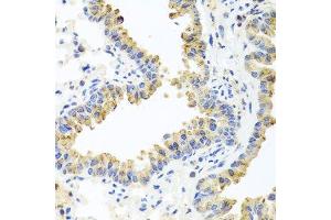 Immunohistochemistry of paraffin-embedded mouse lung using HSPA6 antibody. (HSPA6 抗体  (AA 474-643))