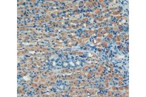 IHC-P analysis of stomach tissue, with DAB staining. (SERPING1 抗体  (AA 148-270))
