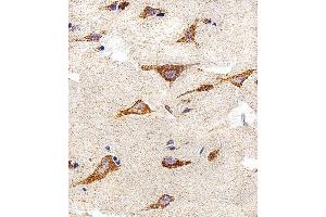 Immunohistochemical analysis of paraffin-embedded H. (IDH3B 抗体  (N-Term))