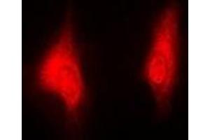 Immunofluorescent analysis of PSMB5 staining in MCF7 cells.