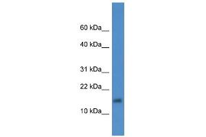 WB Suggested Anti-XAGE2 Antibody Titration: 0. (XAGE2 抗体  (Middle Region))
