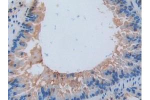 Immunohistochemistry (IHC) image for anti-Interleukin 17 Receptor A (IL17RA) (AA 590-848) antibody (ABIN7438775)