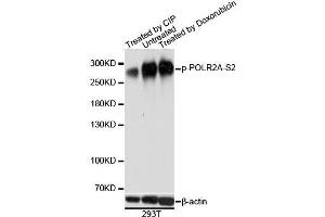 Western blot analysis of extracts of 293T cells, using Phospho-POLR2A-S2 antibody. (POLR2A/RPB1 抗体  (pSer2))