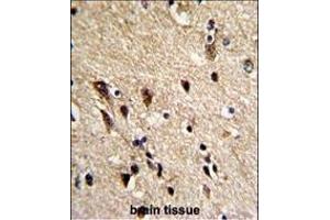 Formalin-fixed and paraffin-embedded human brain reacted with TBB1 Antibody, which was peroxidase-conjugated to the secondary antibody, followed by DAB staining. (TUBB1 抗体)