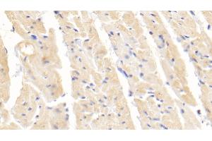 Detection of SOD1 in Rabbit Cardiac Muscle Tissue using Polyclonal Antibody to Superoxide Dismutase 1 (SOD1) (SOD1 抗体  (AA 2-153))