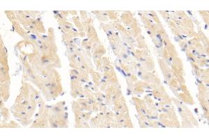 Detection of SOD1 in Rabbit Cardiac Muscle Tissue using Polyclonal Antibody to Superoxide Dismutase 1 (SOD1) (SOD1 抗体  (AA 2-153))