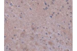 Detection of PPIF in Mouse Cerebrum Tissue using Polyclonal Antibody to Peptidylprolyl Isomerase F (PPIF) (PPIF 抗体  (AA 44-192))