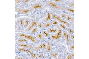 Immunohistochemistry of paraffin-embedded mouse kidney using Caspase-9 Rabbit mAb (ABIN6135366, ABIN7101390, ABIN7101391 and ABIN7101392) at dilution of 1:400 (40x lens). (Caspase 9 抗体)