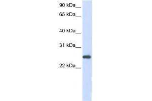 WB Suggested Anti-PRDX1 Antibody Titration:  0. (Peroxiredoxin 1 抗体  (N-Term))