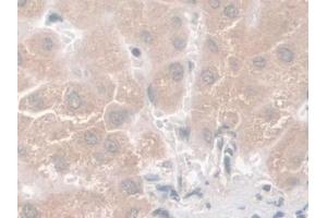 Detection of Nesp2 in Human Liver Tissue using Polyclonal Antibody to Nesprin 2 (Nesp2) (SYNE2 抗体  (AA 6-296))