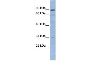 WB Suggested Anti-NFKBIL1 Antibody Titration:  0. (NFKBIL1 抗体  (N-Term))