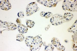 IHC analysis of CCNE1 using anti-CCNE1 antibody (ABIN7601193).