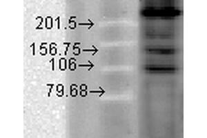 Western Blot analysis of Hamster T-CHO cell lysate showing detection of CaV1. (CACNA1C 抗体  (AA 1507-1733) (Atto 390))