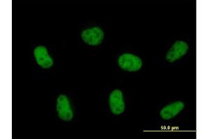 Immunofluorescence of purified MaxPab antibody to ZCCHC8 on HeLa cell. (ZCCHC8 抗体  (AA 1-707))
