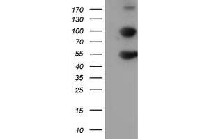 Western Blotting (WB) image for anti-Histidyl-tRNA Synthetase 2, Mitochondrial (Putative) (HARS2) antibody (ABIN1498583) (HARS2 抗体)
