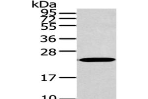 Western Blot analysis of 293T cells using ARL2 Polyclonal Antibody at dilution of 1/200 (ARL2 抗体)