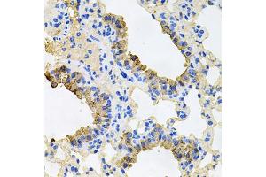 Immunohistochemistry of paraffin-embedded mouse lung using IGF1R antibody (ABIN5970073) at dilution of 1/100 (40x lens). (IGF1R 抗体  (N-Term))