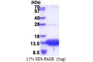SDS-PAGE (SDS) image for Organic Solute Transporter beta (OSTBETA) (AA 57-128) protein (His tag) (ABIN5853290)
