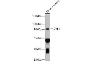 Western blot analysis of extracts of Mouse kidney, using DVL1 antibody (ABIN7266796) at 1:1000 dilution. (DVL1 抗体  (AA 510-640))
