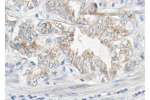 AF3132 at 1/100 staining human Prostate tissue sections by IHC-P. (PDGFRB 抗体  (pTyr1021))