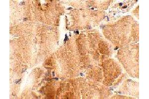Immunohistochemistry of JPH2 in mouse skeletal muscle tissue with JPH2 polyclonal antibody  at 2. (Junctophilin 2 抗体  (C-Term))