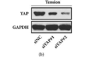 Western Blotting (WB) image for anti-Yes-Associated Protein 1 (YAP1) antibody (ABIN1683302)