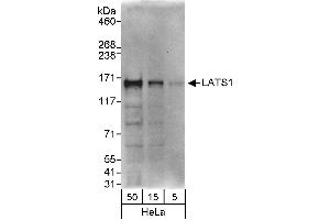 Western Blotting (WB) image for anti-LATS, Large Tumor Suppressor, Homolog 1 (Drosophila) (LATS1) (C-Term) antibody (ABIN7451562)