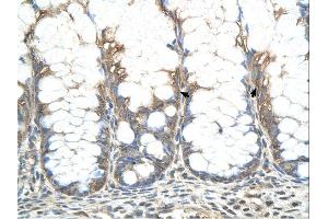 CHIC2 antibody was used for immunohistochemistry at a concentration of 4-8 ug/ml. (CHIC2 抗体  (N-Term))