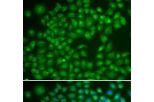 Immunofluorescence analysis of MCF-7 cells using RAB4A Polyclonal Antibody (Rab4 抗体)