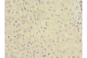 Immunohistochemistry of paraffin-embedded human liver tissue using ABIN7157750 at dilution of 1:100 (KYNU 抗体  (AA 1-307))