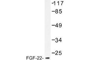 Image no. 1 for anti-Fibroblast Growth Factor 22 (FGF22) antibody (ABIN317810) (FGF22 抗体)