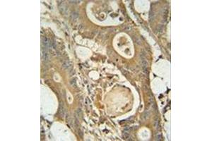 Immunohistochemistry (Paraffin-embedded Sections) (IHC (p)) image for anti-Glucosaminyl (N-Acetyl) Transferase 3, Mucin Type (GCNT3) (AA 390-418), (C-Term) antibody (ABIN952482)