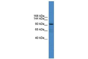 WB Suggested Anti-XYLT1 Antibody Titration:  0. (XYLT1 抗体  (Middle Region))