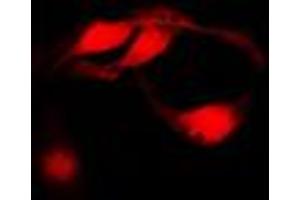 Immunofluorescent analysis of CHK1 staining in HeLa cells. (CHEK1 抗体  (Center))