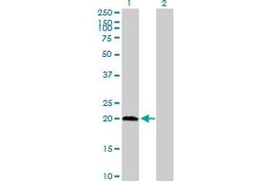 Western Blot analysis of PPCDC expression in transfected 293T cell line by PPCDC MaxPab polyclonal antibody. (PPCDC 抗体  (AA 1-204))