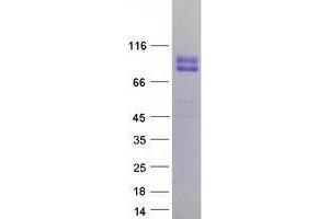 Validation with Western Blot (Endoglin Protein (ENG) (Transcript Variant 1) (Myc-DYKDDDDK Tag))