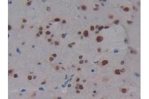 Immunohistochemistry (IHC) image for anti-KH Domain Containing, RNA Binding, Signal Transduction Associated 1 (KHDRBS1) (AA 156-381) antibody (ABIN7441811)
