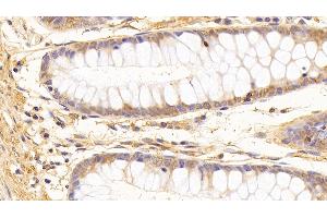 Immunohistochemistry (IHC) image for anti-Tubulin, beta (TUBB) (AA 170-419) antibody (ABIN7428434)