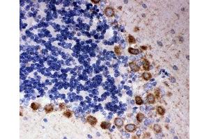 IHC-P: DISC1 antibody testing of rat cerebellum tissue (DISC1 抗体  (Middle Region))