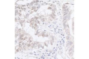 Immunohistochemistry (IHC) image for anti-Adenosine Deaminase, RNA-Specific (ADAR) (AA 200-250) antibody (ABIN7453418)