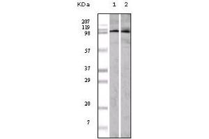 Western Blotting (WB) image for anti-Ephrin Type A Receptor 1 (EPHA1) (truncated) antibody (ABIN2464049) (EPHA1 抗体  (truncated))