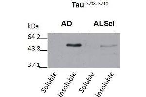 Western blot detection of insoluble phospho-Tau protein using the anti-Tau (Ser 208/210) antibody in samples isolated from patients with a neurodegenerative disease (Amyotropic lateral sclerosis, ALS or Alzheimer’s disease, AD (tau 抗体  (pSer208, pSer210))
