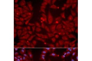 Immunofluorescence analysis of U2OS cells using GRIK2 Polyclonal Antibody (GRIK2 抗体)